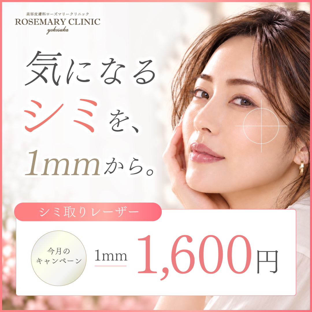 シミ取りレーザー