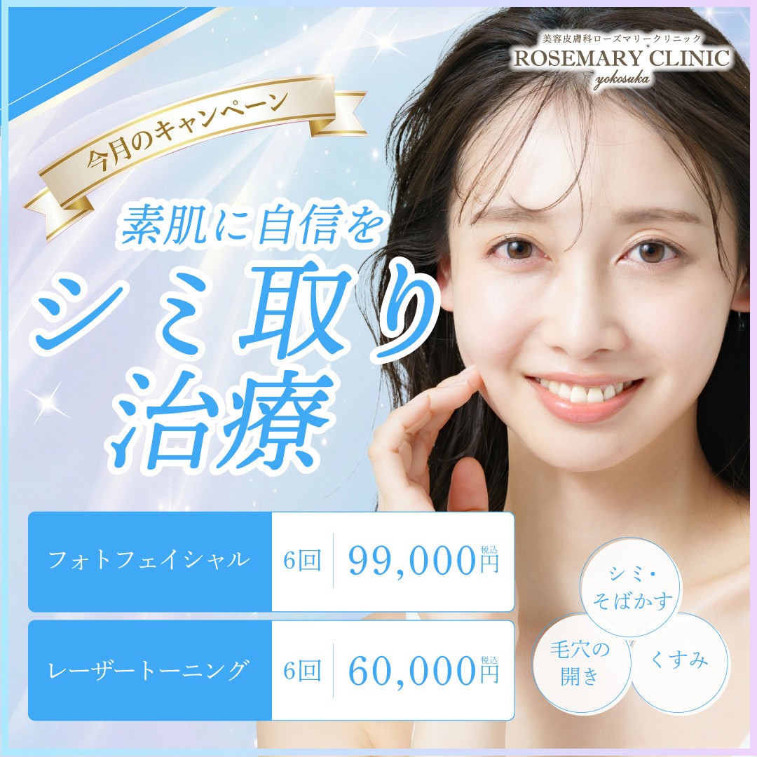 シミ取りキャンペーン