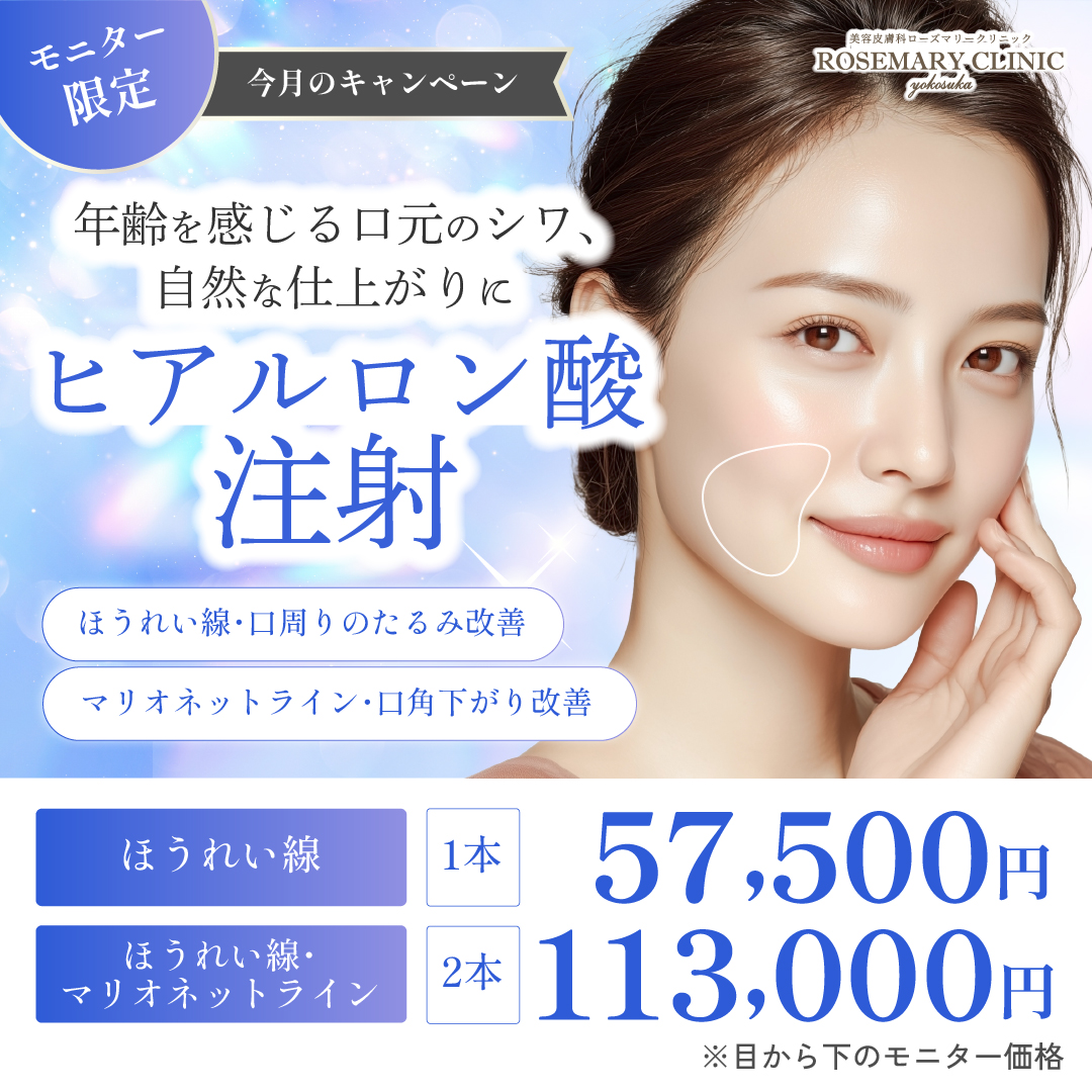 ヒアルロン酸注射　モニターキャンペーン