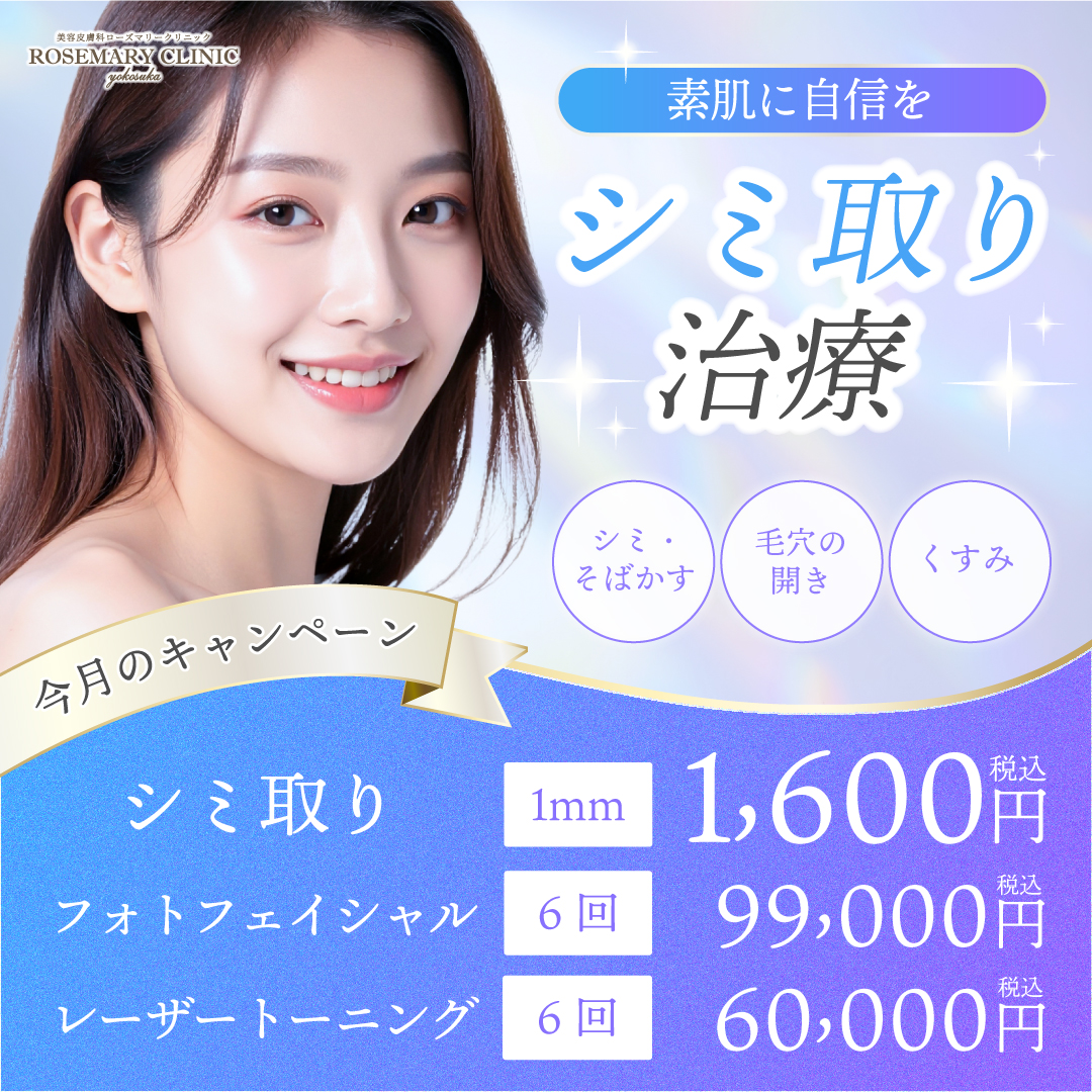 シミ取りキャンペーン