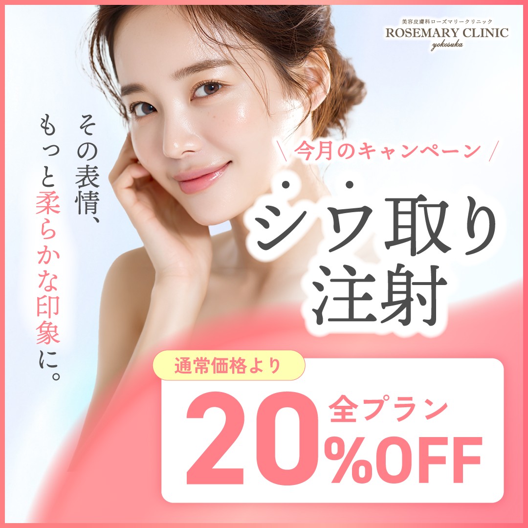 ボトックス注射　20%OFF